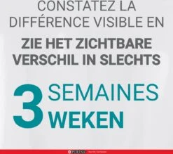 Purina One Sensitive - Kalkoen/Rijst - Kattenvoer - 800 G -Kattenspeelgoed Winkel 1200x1063 1